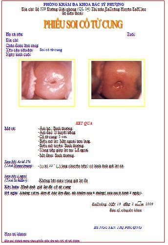 Phầm mềm soi cổ tử cung