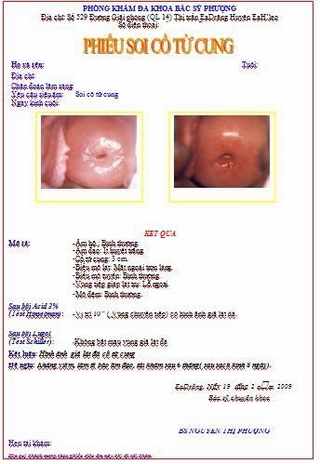 Phầm mềm soi cổ tử cung